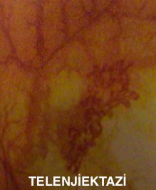 telenjiektazi